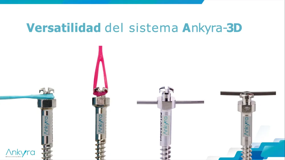 ANKYRA KIT